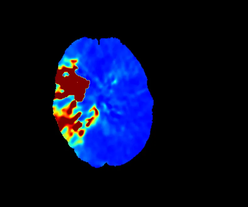 Siemens Healthineers und Cercare Medical bestätigen Zusammenarbeit