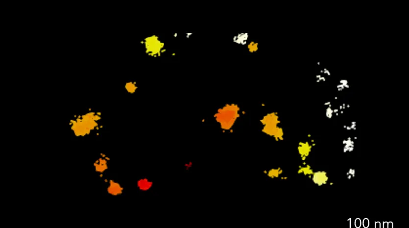 Neue Erkenntnisse für innovative Therapien bei Hörstörungen?