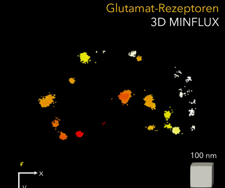 Neue Erkenntnisse für innovative Therapien bei Hörstörungen?